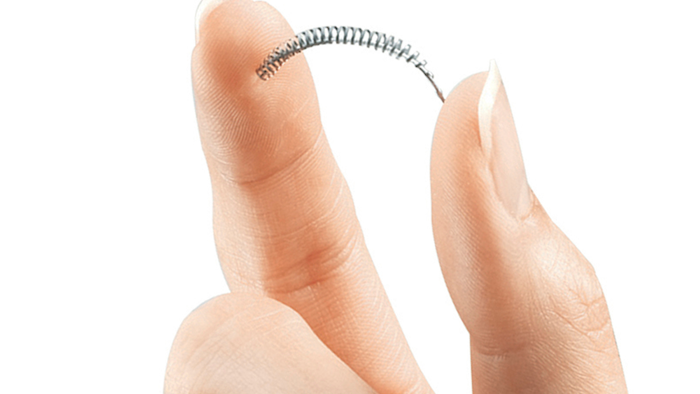 This image provided by Bayer Healthcare Pharmaceuticals shows the birth control implant Essure.