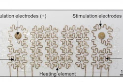 New wearable device capable of recording the electrical activity of the heart and muscles, as well as delivering therapeutic electrical and thermal stimulations. It is suitable for flexible joints, like the wrist, and allows reliable heat transfer even when the wrist is flexed or extended.