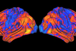 Psychiatry professor Hugh Garavan’s NIH-funded research uses brain scans like the ones above to determine the impact of drugs and alcohol on brain development in youth. The VACC upgrade will greatly facilitate this work.