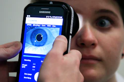 Clinical Research Assistant Kevin Jackson uses AlgometRx Platform Technology on Sarah Taylor's eyes at the Children's National Medical Center in Washington, Monday, Dec. 10, 2018.