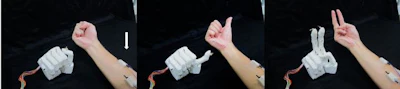The prosthetic hand uses signals from electrodes (arrow) and machine learning to copy hand positions.