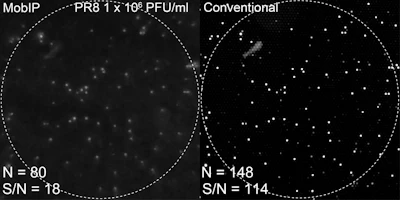 Images are clearer with microscopes (right) but smartphones continually improve.