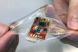A wireless, wearable monitor built with stretchable electronics could allow comfortable, long-term health monitoring of adults, babies and children.