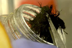 Researchers at Texas Heart Institute and Rice University have confirmed that flexible, conductive fibers made of carbon nanotubes can bridge damaged tissue to deliver electrical signals and keep hearts beating despite congestive heart failure or dilated cardiomyopathy or after a heart attack.