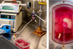 Left: The bioreactor. Right: A rat liver scaffold that has been populated with engineered human liver, vascular and inflammatory cells.