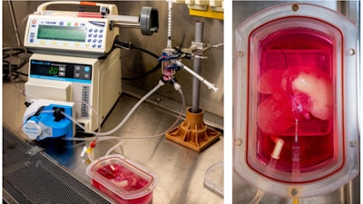 Left: The bioreactor. Right: A rat liver scaffold that has been populated with engineered human liver, vascular and inflammatory cells.