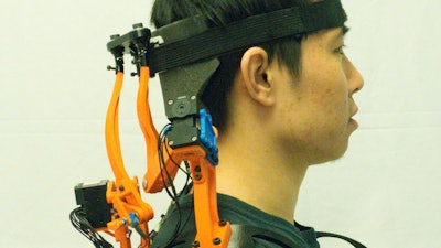 A study participant wearing the robotic neck brace that dramatically improves functions of ALS patients. The comfortable brace incorporates both sensors and actuators to restore roughly 70% of the active range of motion.