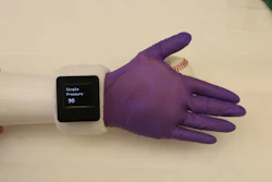 An electronic glove, developed by Purdue University researchers, offers 'humanlike' features for prosthetic hand users.