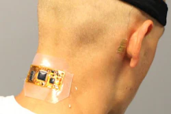Test subject who has flexible wireless electronics conformed to the back of the neck, with dry hair electrodes under a fabric headband and a membrane electrode on the mastoid, connected with thin-film cables.