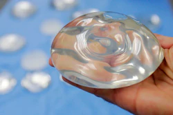This Dec. 11, 2006, file photo shows a silicone gel breast implant in Irving, Texas.