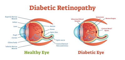 Diabetic