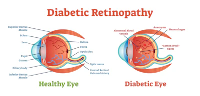 Diabetic