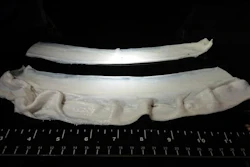 Gelatin fibers produced by 'immersion rotary jet spinning', a fiber production system inspired by cotton candy. These fibers form the 'base' to grow cells in -- they mimic natural muscle tissue's extracellular 'glue', which holds the tissue together and contribute to its texture.