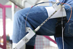 The energy harvester device is extremely light with only 307 grams.