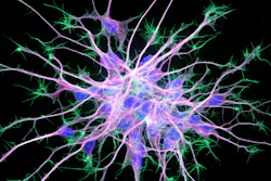 Neuron Stem Cells2
