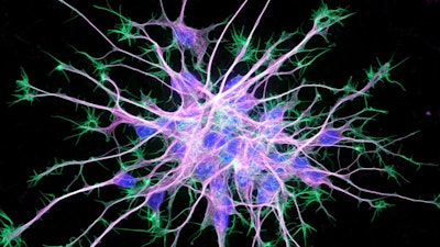 Neuron Stem Cells2