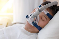Sleep Apnea