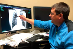 In this Jan. 24, 2019, file photo Dr. Brandon Crum points to the X-ray of a black lung patient at his office in Pikeville, Ky.