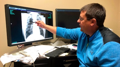 In this Jan. 24, 2019, file photo Dr. Brandon Crum points to the X-ray of a black lung patient at his office in Pikeville, Ky.