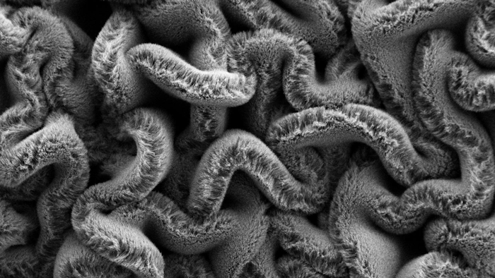 When carbon nanotube forests are placed on an elastomer substrate pre-stretched in two directions, it creates a maze of spaghetti instead of rows, improving the stretchable supercapacitor's performance.
