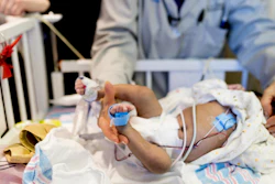A neonate wears wireless sensors (in blue) and traditional, wired sensors in an evaluation at Prentice Women's Hospital in Chicago.