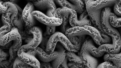 When carbon nanotube forests are placed on an elastomer substrate pre-stretched in two directions, it creates a maze of spaghetti instead of rows, improving the stretchable supercapacitor's performance.