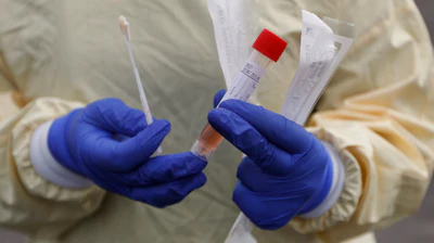 A nurse holds swabs and test tube to test people for COVID-19 at a drive through station set up in the parking lot of the Beaumont Hospital in Royal Oak, Mich., March 16, 2020.