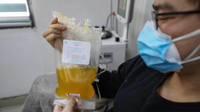 Dr. Zhou Min, a recovered COVID-19 patient, donates plasma in Wuhan, Feb. 18, 2020.