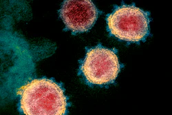 This electron microscope image, made available by the U.S. National Institutes of Health in February 2020, shows the virus that causes COVID-19.