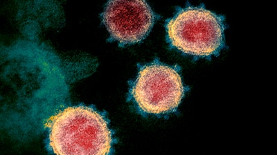 This electron microscope image, made available by the U.S. National Institutes of Health in February 2020, shows the virus that causes COVID-19.