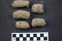 H35 (Ash pit number 35) coprolites from Xiaosungang archaeological site, Anhui Province, China.
