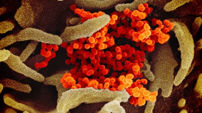SARS-CoV-2 emerging from the surface of cells cultured in a lab.