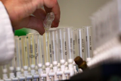 A laboratory technician prepares samples of urine for doping tests at the King's College Drug Control Centre, London, Feb. 5, 2010.