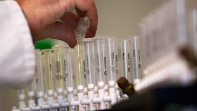 A laboratory technician prepares samples of urine for doping tests at the King's College Drug Control Centre, London, Feb. 5, 2010.