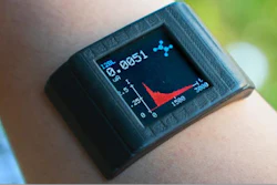 The underside of this custom-built smartwatch contains a double-sided adhesive that can detect metabolites and nutrients present in body sweat.
