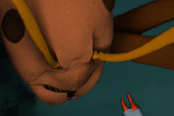 The optical pliers next to the mandibles of a Formica polyctena ant for comparison.