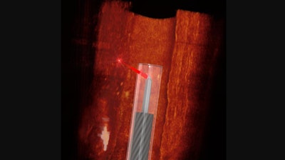 Ultra-thin, 3D-printed endoscope imaging an artery.