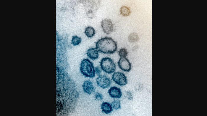 Electron microscope file image of SARS-CoV-2.
