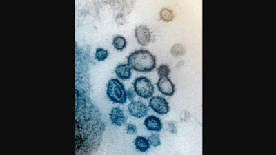 Electron microscope file image of SARS-CoV-2.