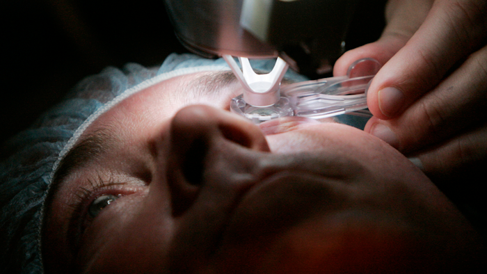 Dr. Colman Kraff uses a laser during eye surgery at Kraff's offices in Chicago, Nov. 1, 2005.