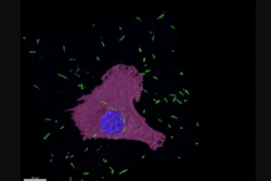 Confocal fluorescence image of gold nanotures (green) in mesothelioma cells