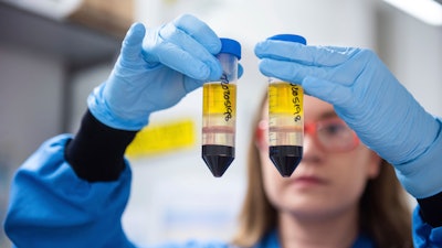 In this undated file photo issued by the University of Oxford on Monday, Nov. 23, 2020, a researcher in a laboratory at the Jenner Institute in Oxford, England, works on the coronavirus vaccine developed by AstraZeneca and Oxford University.