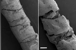 Scanning electron microscopy of carbon ink-coated threads.