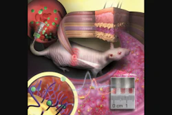 Gold nanoparticles embedded in a porous hydrogel can be implanted under the skin and used as medical sensors.