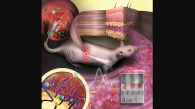 Gold nanoparticles embedded in a porous hydrogel can be implanted under the skin and used as medical sensors.