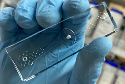 A 'worm-on-a-chip' device tracks nematodes' movements toward odor molecules produced by lung cancer cells.