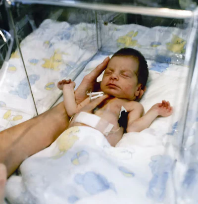 Baby Fae was the first successful infant xenotransplant, surviving for 20 days with a baboon heart.