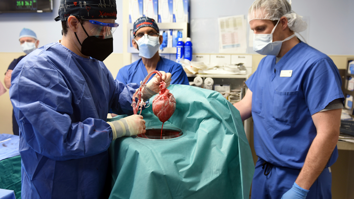 In this photo provided by the University of Maryland School of Medicine, members of the surgical team show the pig heart for transplant into patient David Bennett in Baltimore on Friday, Jan. 7, 2022. Researchers trying to learn what killed Bennett, the first person to receive a heart transplant from a pig, have discovered signs of an animal virus in the organ but cannot yet say if it played any role in the man’s death.
