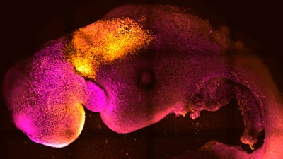 This microscope image provided by researchers Gianluca Amadei and Charlotte Handford in August 2022 shows a synthetic mouse embryo with colors added to show brain and heart formation. According to a study published in the journal Nature on Thursday, Aug. 25, scientists have created “synthetic” mouse embryos from stem cells without a dad's sperm or a mom's egg or womb.