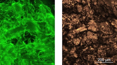 The hydrogels stained with a fluorescent dye that binds to amyloid structures and the corresponding brightfield image.